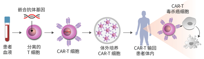 CAR-T