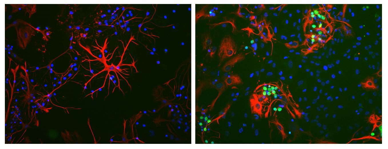 anti-c-fos antibody [2h2]