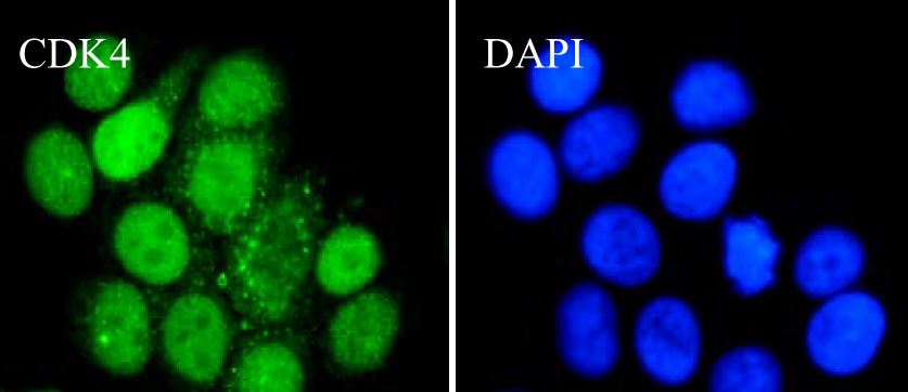 ARG66316anti-CDK4 antibody [SQab1864]