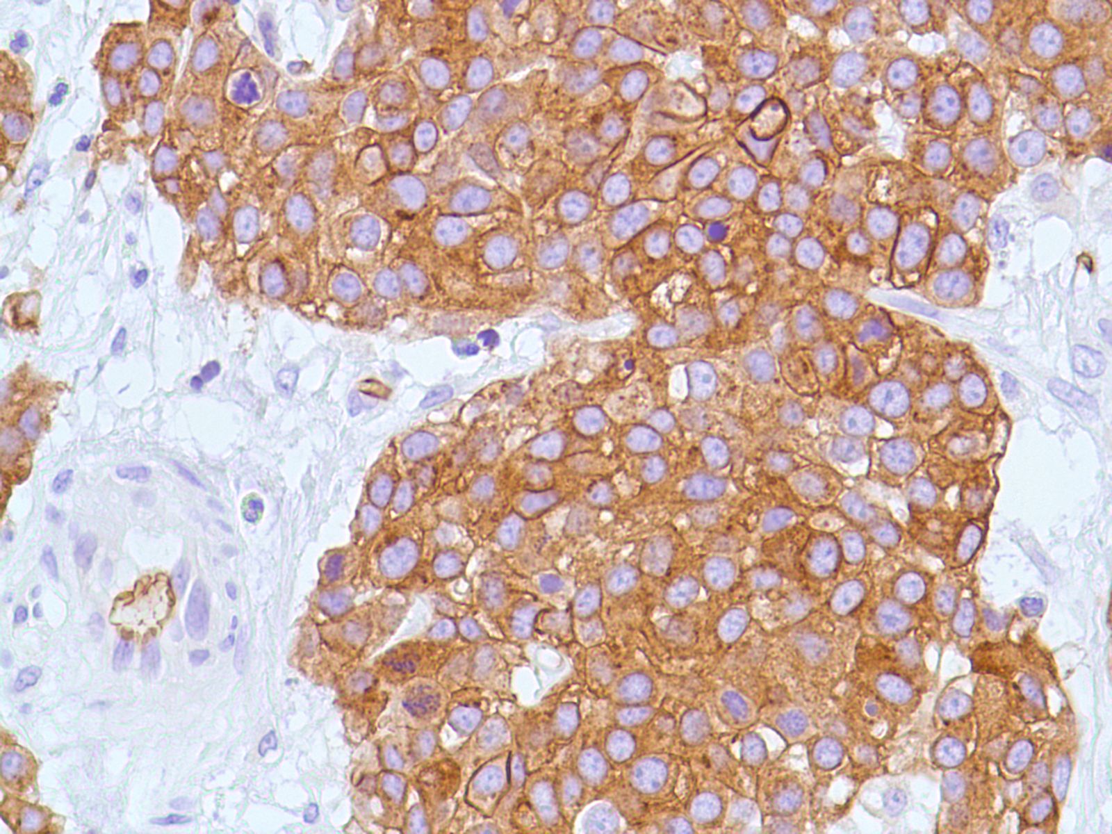 [spm498] immunohistochemistry: human bladder transitional cell